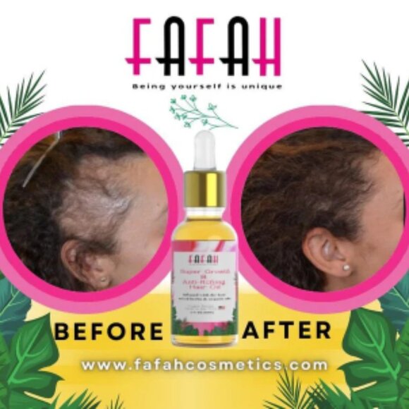 The Fafah Super Growth & Anti-Itching Hair Oil ( 2 oz) - Picture 8 of 10